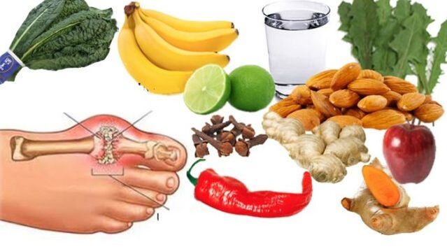 Patients with gout are prescribed a bland diet.