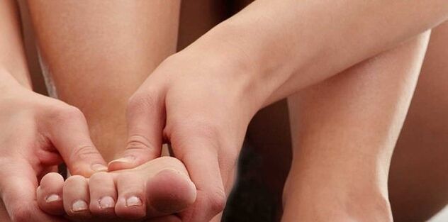 gout diet